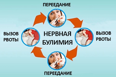 Лечение булимии в Муроме